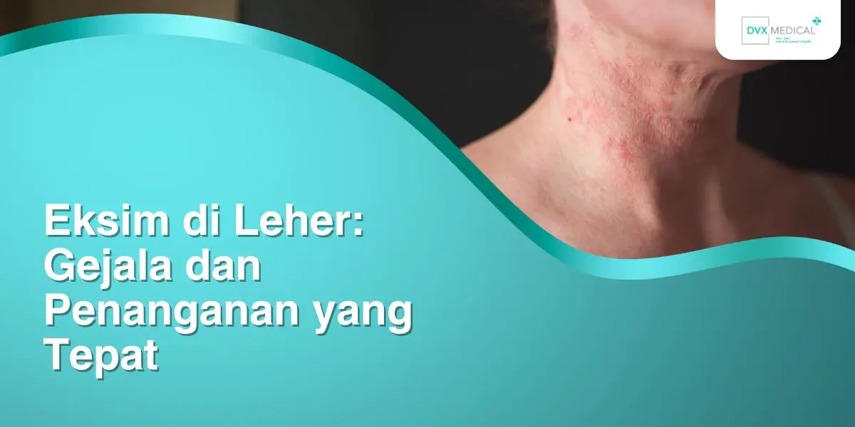 Eksim di Leher: Gejala dan Penanganan yang Tepat