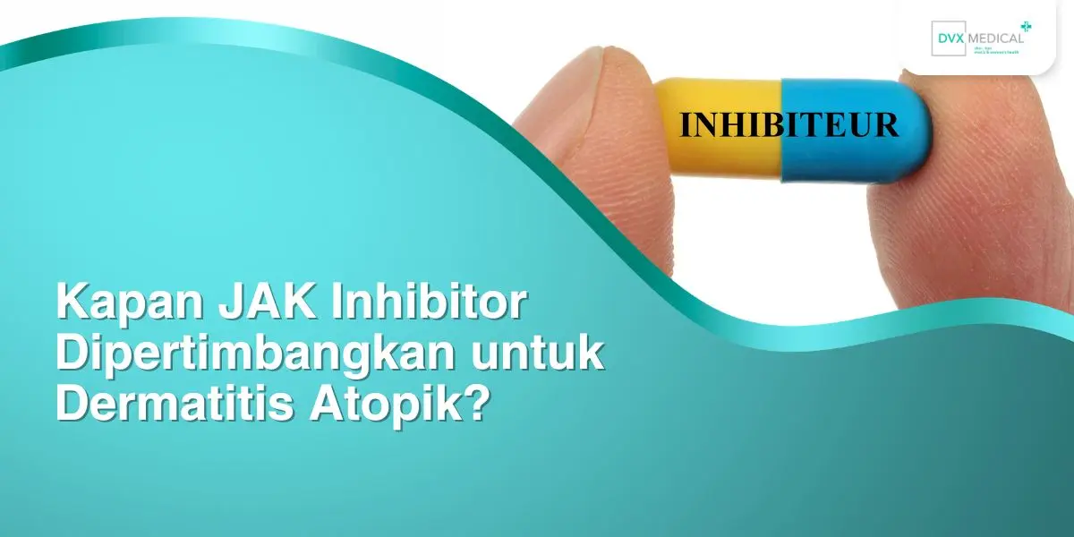 Kapan JAK Inhibitor Dipertimbangkan untuk Dermatitis Atopik?