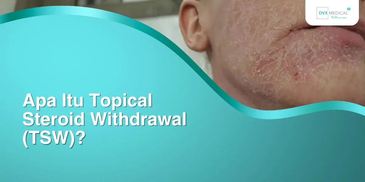 Apa Itu Topical Steroid Withdrawal (TSW)?