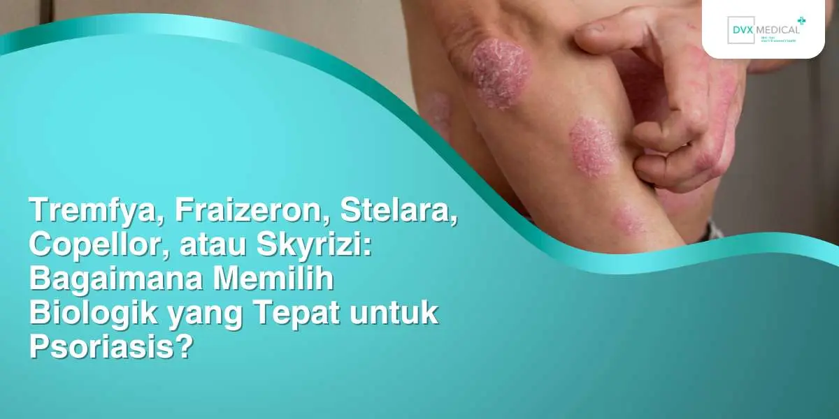 Tremfya, Fraizeron, Stelara, Copellor, atau Skyrizi: Bagaimana Memilih Biologik yang Tepat untuk Psoriasis?