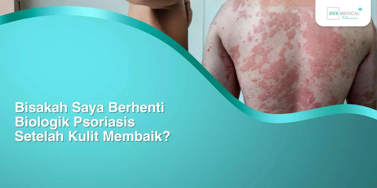 Bisakah Saya Berhenti Biologik Psoriasis Setelah Kulit Membaik?
