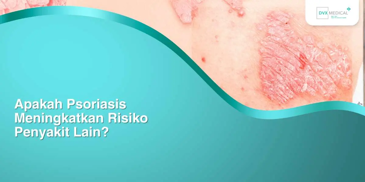Apakah Psoriasis Meningkatkan Risiko Penyakit Lain?