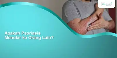 Apakah Psoriasis Menular ke Orang Lain?