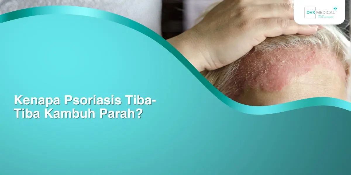 Kenapa Psoriasis Tiba-Tiba Kambuh Parah?