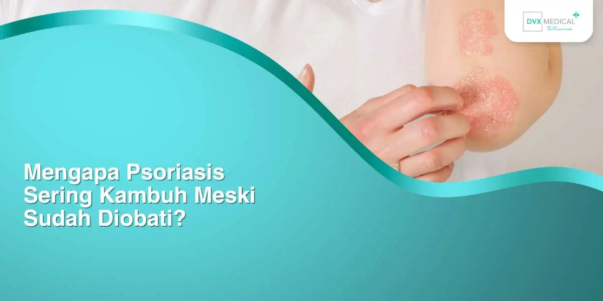 Mengapa Psoriasis Sering Kambuh Meski Sudah Diobati?