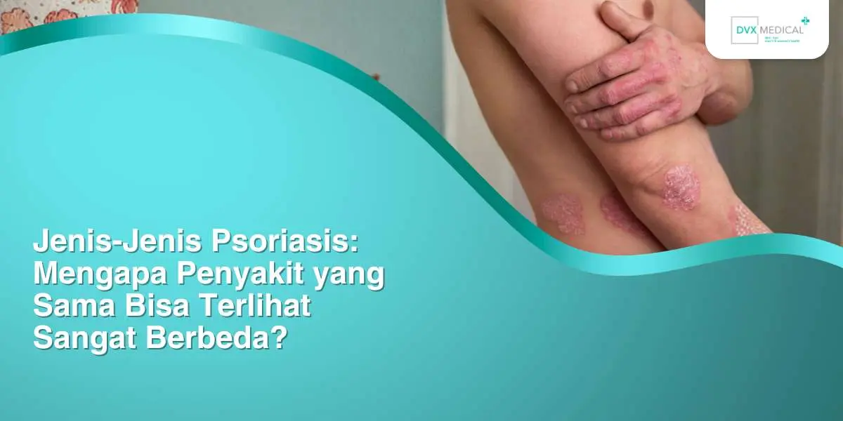 Jenis-Jenis Psoriasis: Mengapa Penyakit yang Sama Bisa Terlihat Sangat Berbeda?
