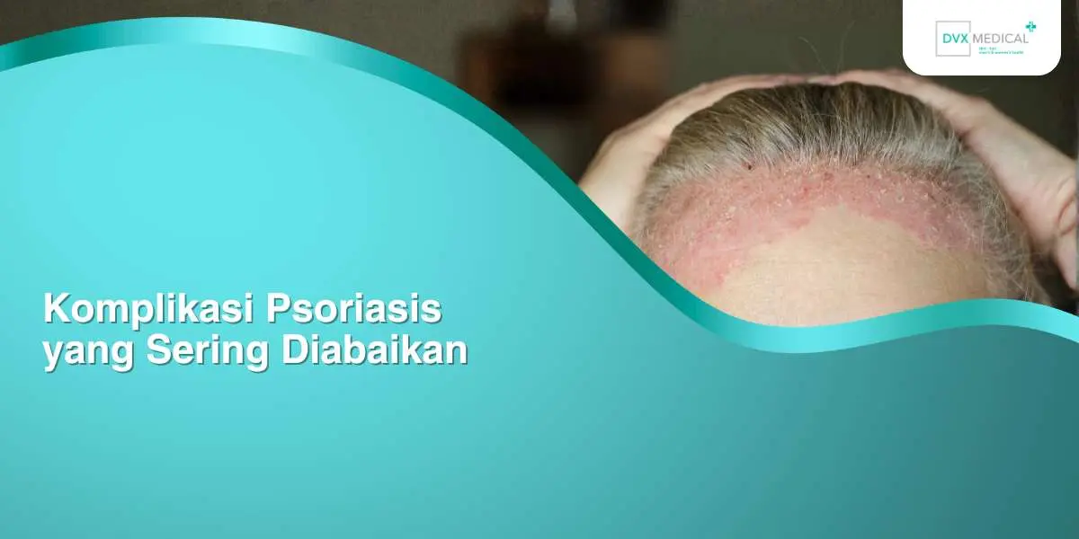 Komplikasi Psoriasis yang Sering Diabaikan