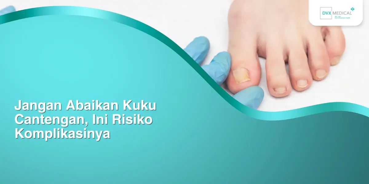 Jangan Abaikan Kuku Cantengan, Ini Risiko Komplikasinya
