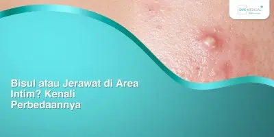 Bisul atau Jerawat di Area Intim? Kenali Perbedaannya