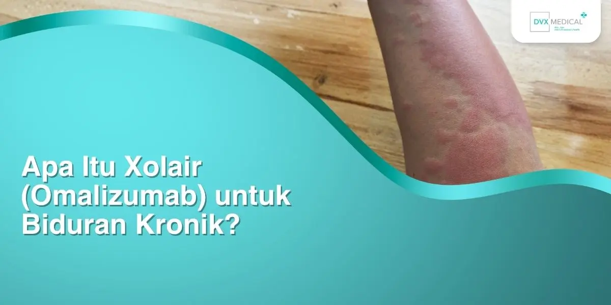 Apa Itu Xolair (Omalizumab) untuk Biduran Kronik?