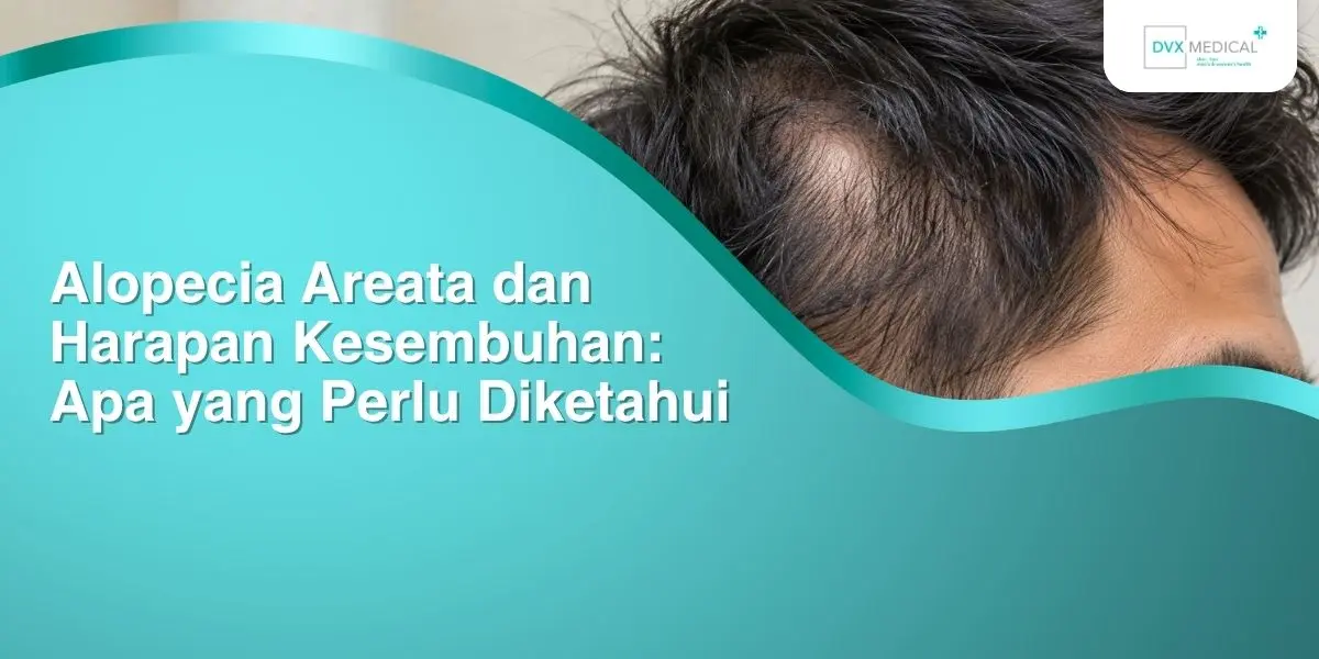 Alopecia Areata dan Harapan Kesembuhan: Apa yang Perlu Diketahui
