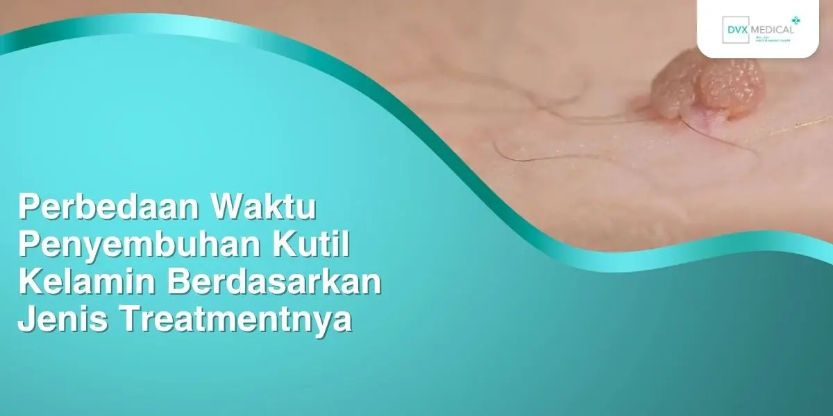 Perbedaan Waktu Penyembuhan Kutil Kelamin Berdasarkan Jenis Treatmentnya