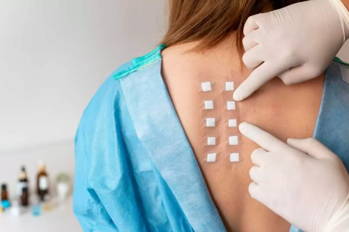 Pengertian Skin Patch Test