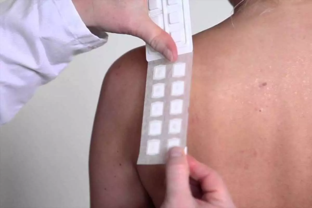 Mengapa Perlu Melakukan Patch Test?