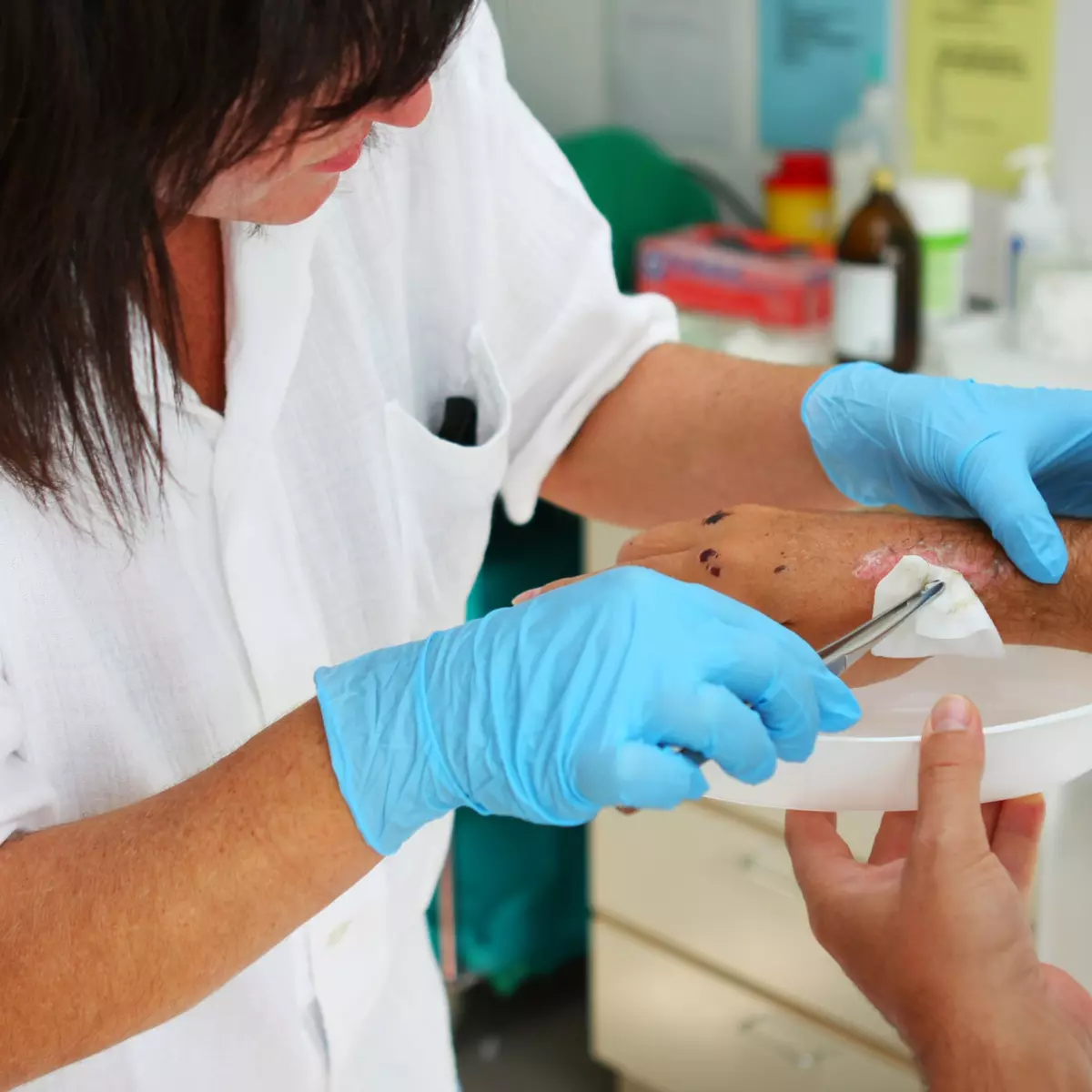 Pengobatan Luka di Kelamin di Klinik DVX Medical