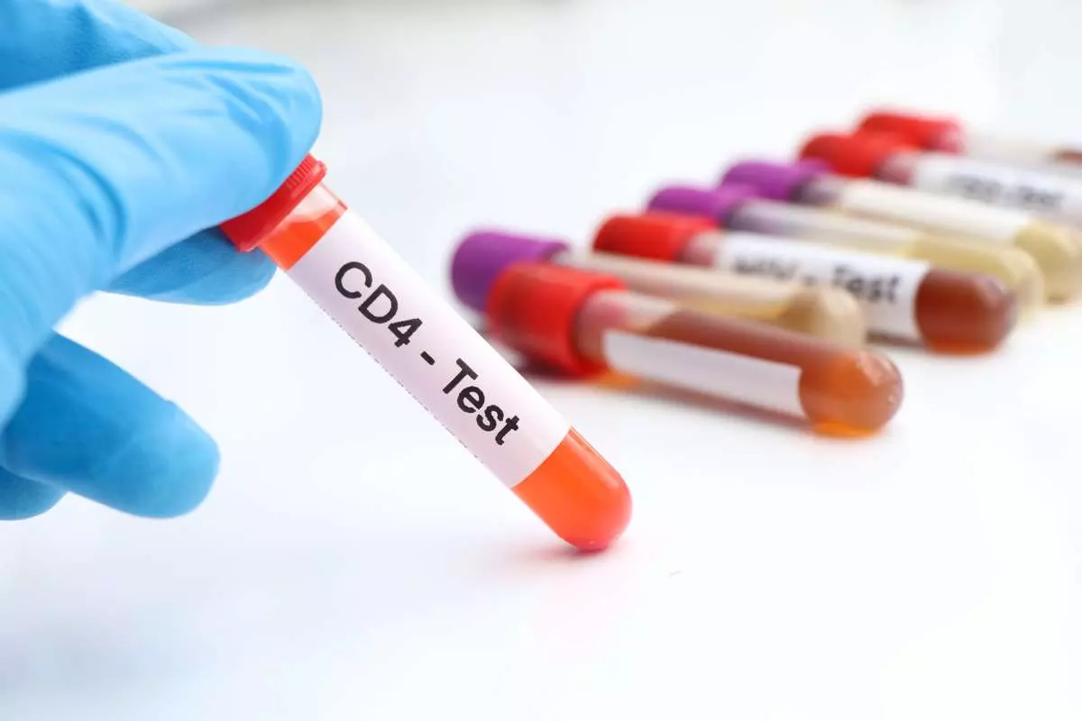 Cara Meningkatkan Jumlah Sel CD4