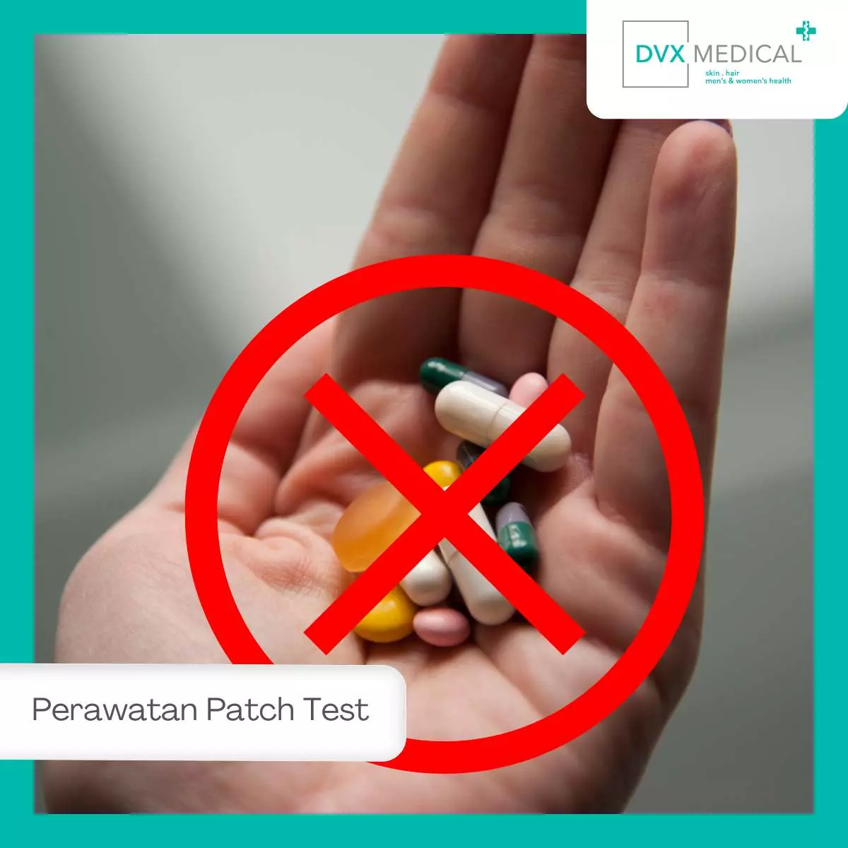 Perawatan Setelah Patch Test