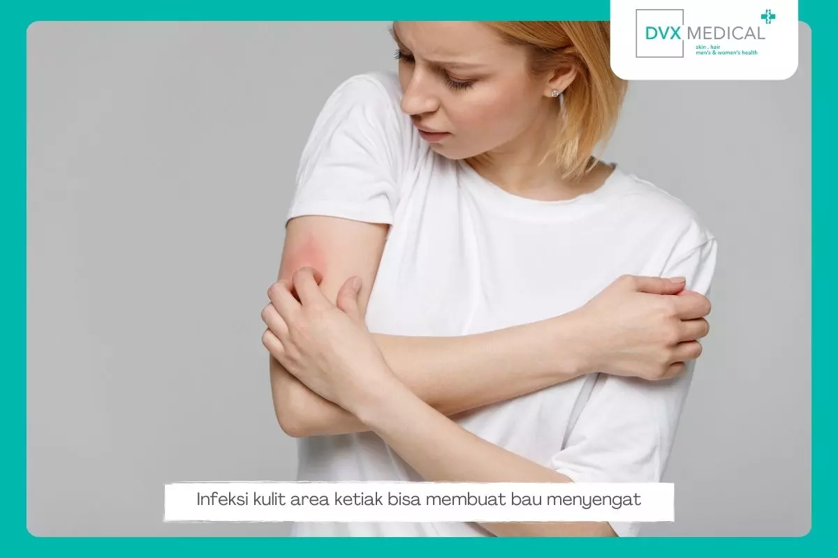 4. Infeksi Kulit 