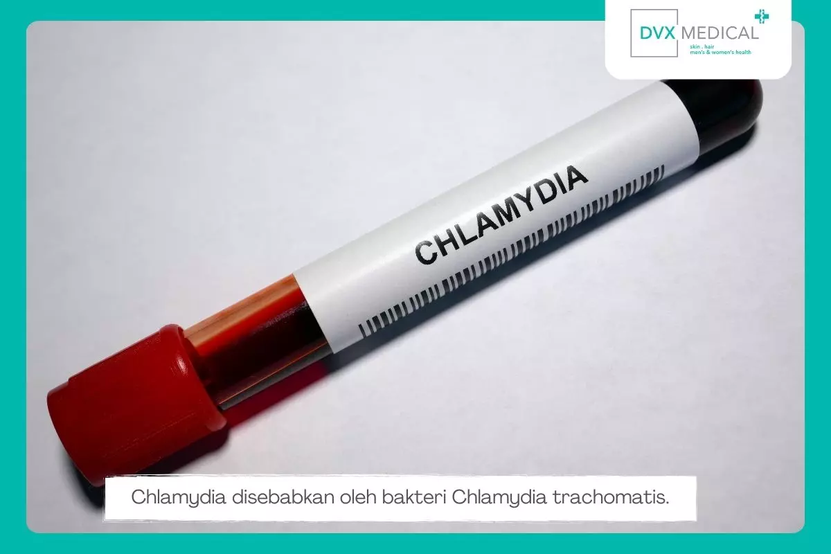 1. Chlamydia
