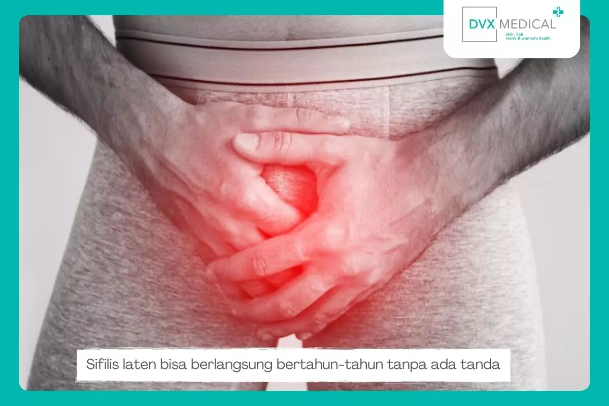 Step 3: Sifilis Laten