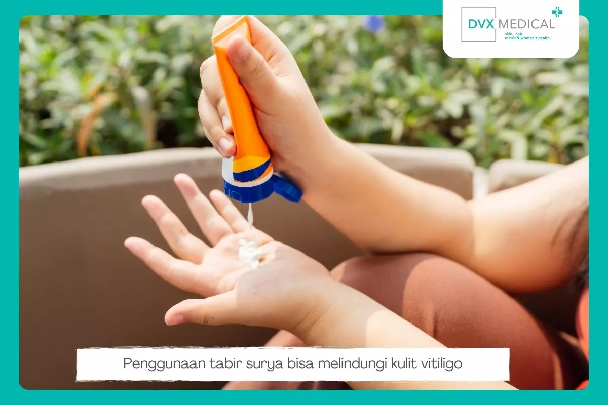 1. Lindungi Kulit dari Paparan Sinar Matahari