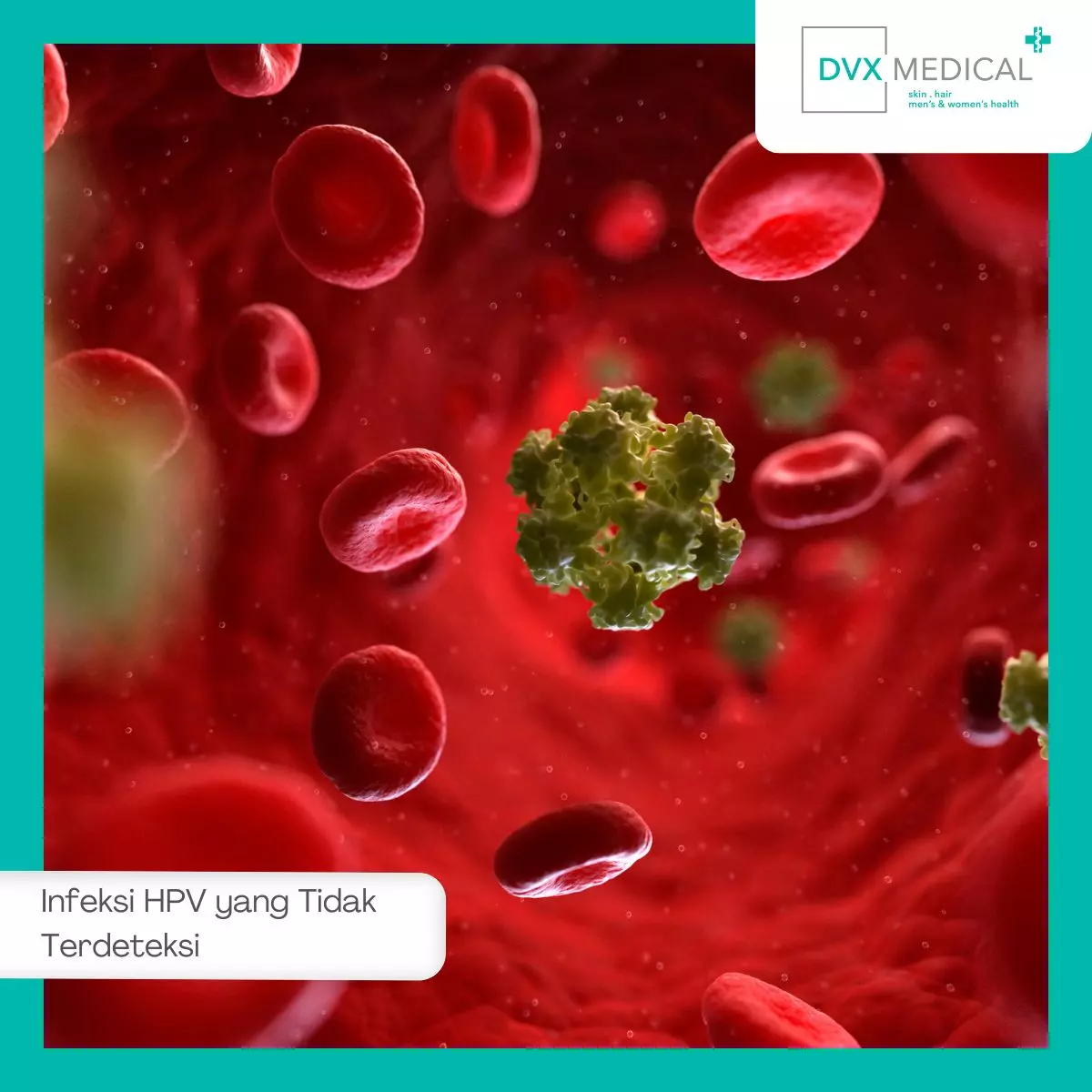 1. Infeksi HPV yang Tidak Terdeteksi