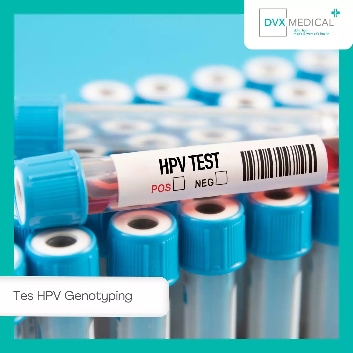 Apa itu Tes HPV Genotyping?