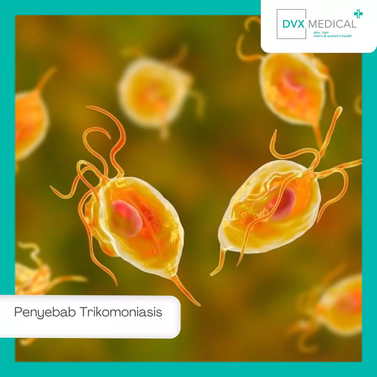 Penyebab Trikomoniasis