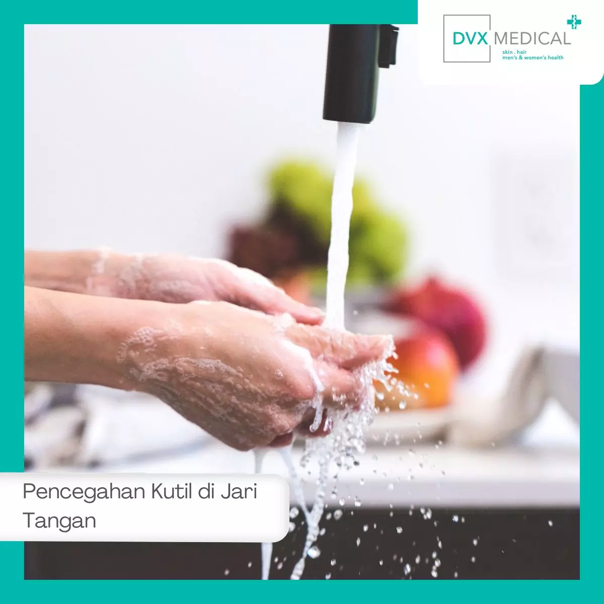 Pencegahan Kutil di Jari Tangan