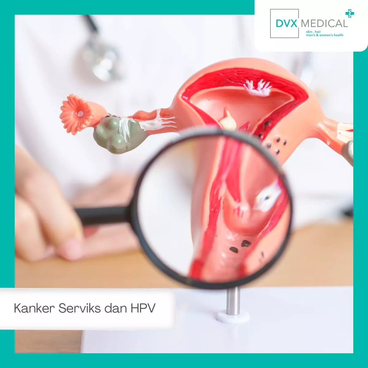 Kanker Serviks dan HPV