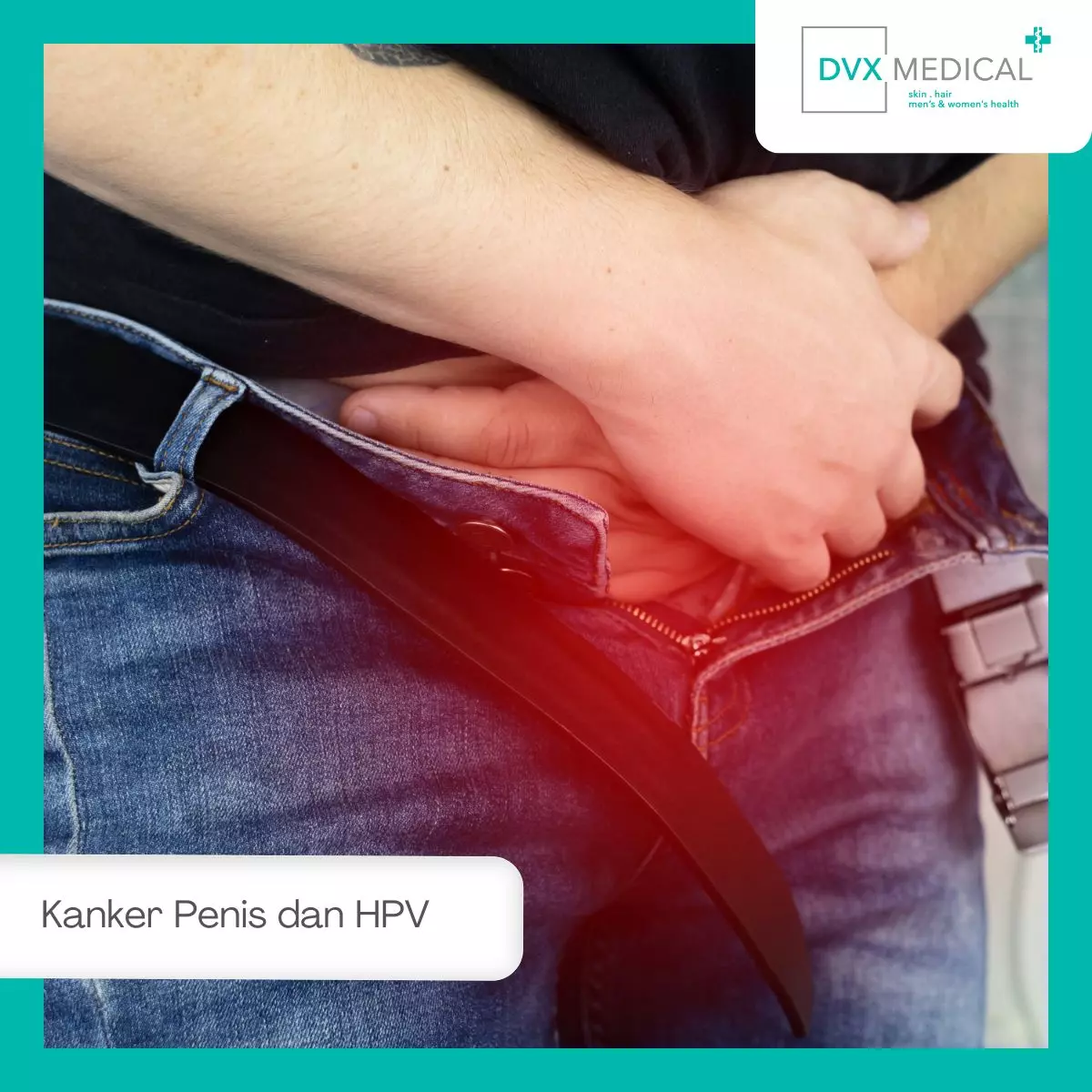 Kanker Penis dan HPV