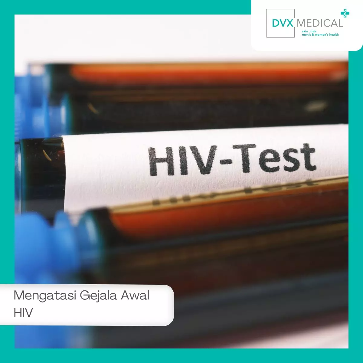 Cara Mengatasi Gejala Awal HIV dan Langkah Selanjutnya