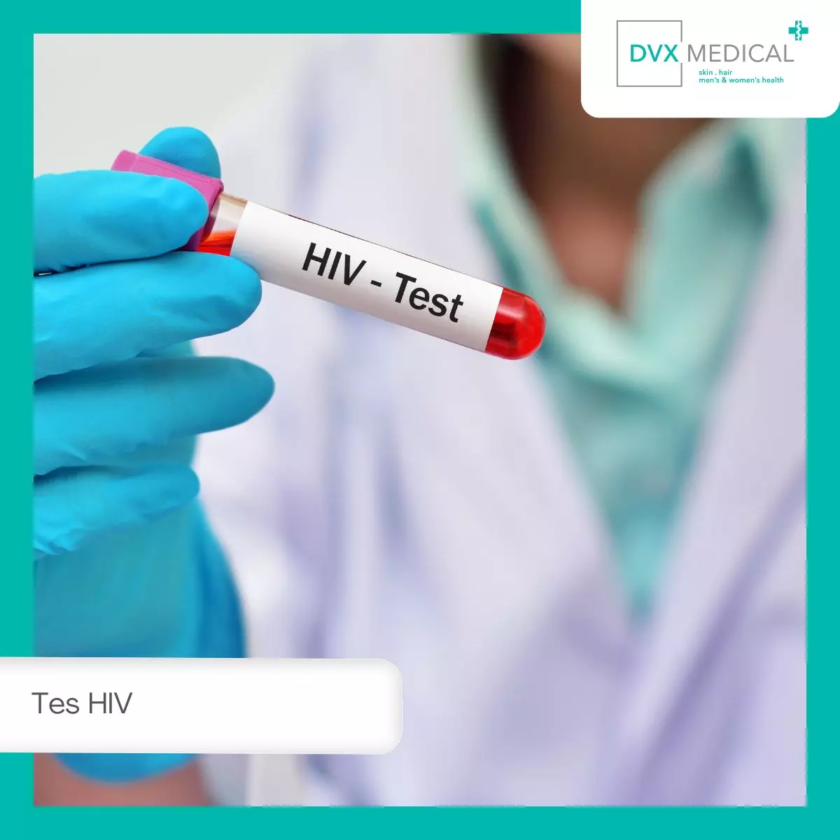 Apa Itu Tes HIV?