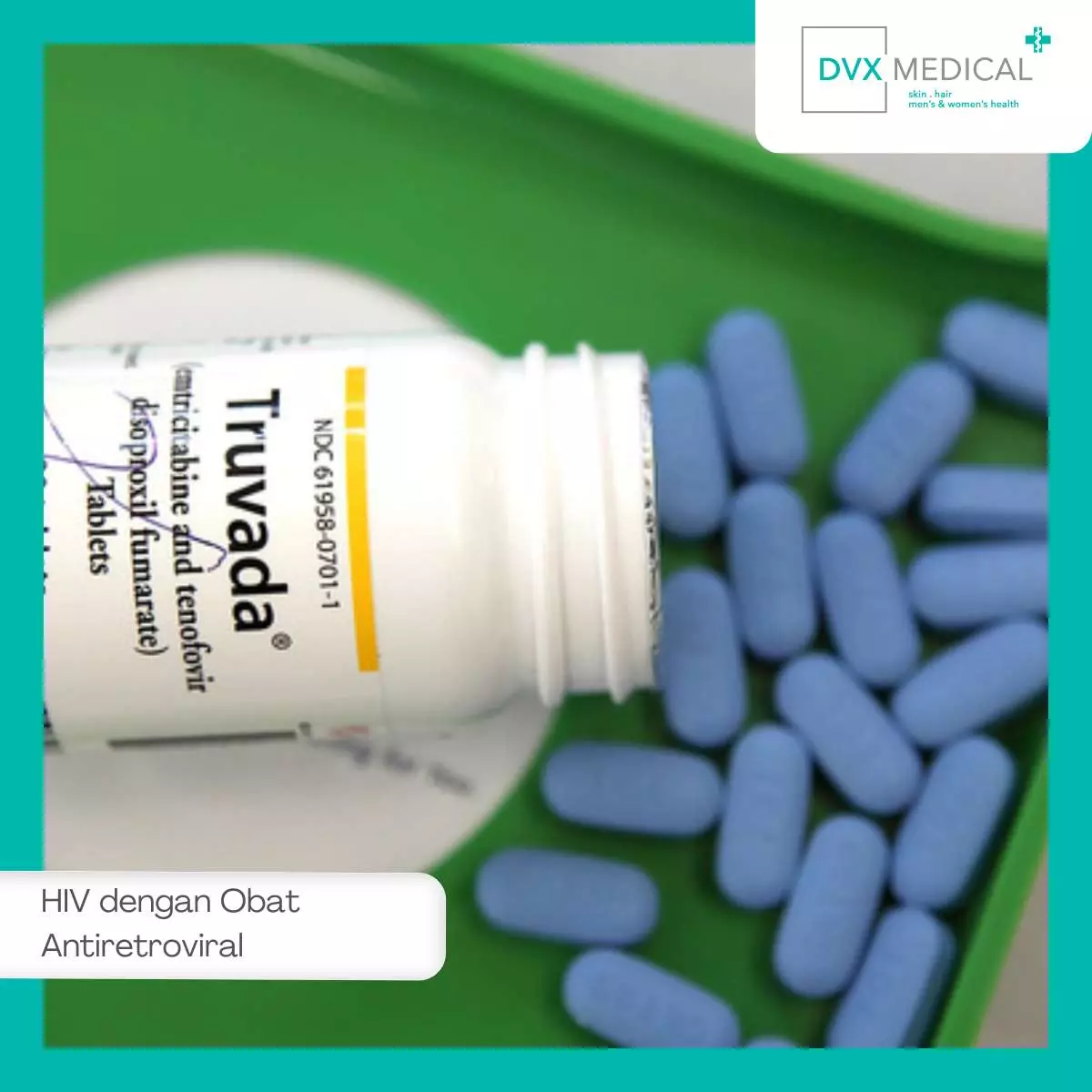 Akses dan Ketersediaan Obat Antiretroviral untuk HIV di Indonesia