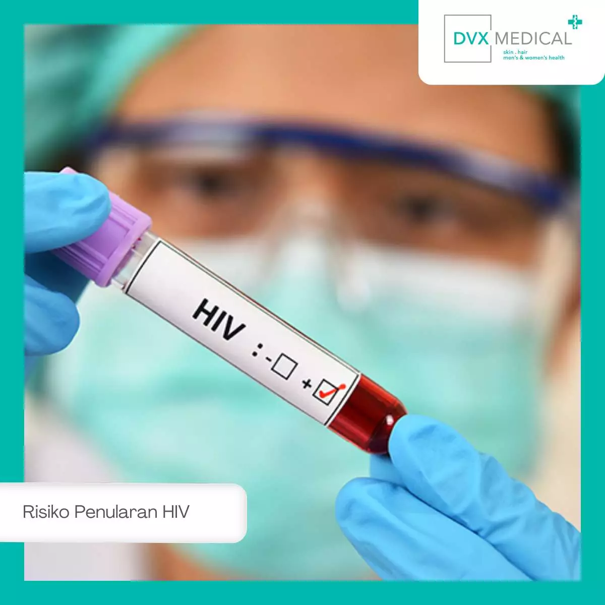 Proses Penularan HIV