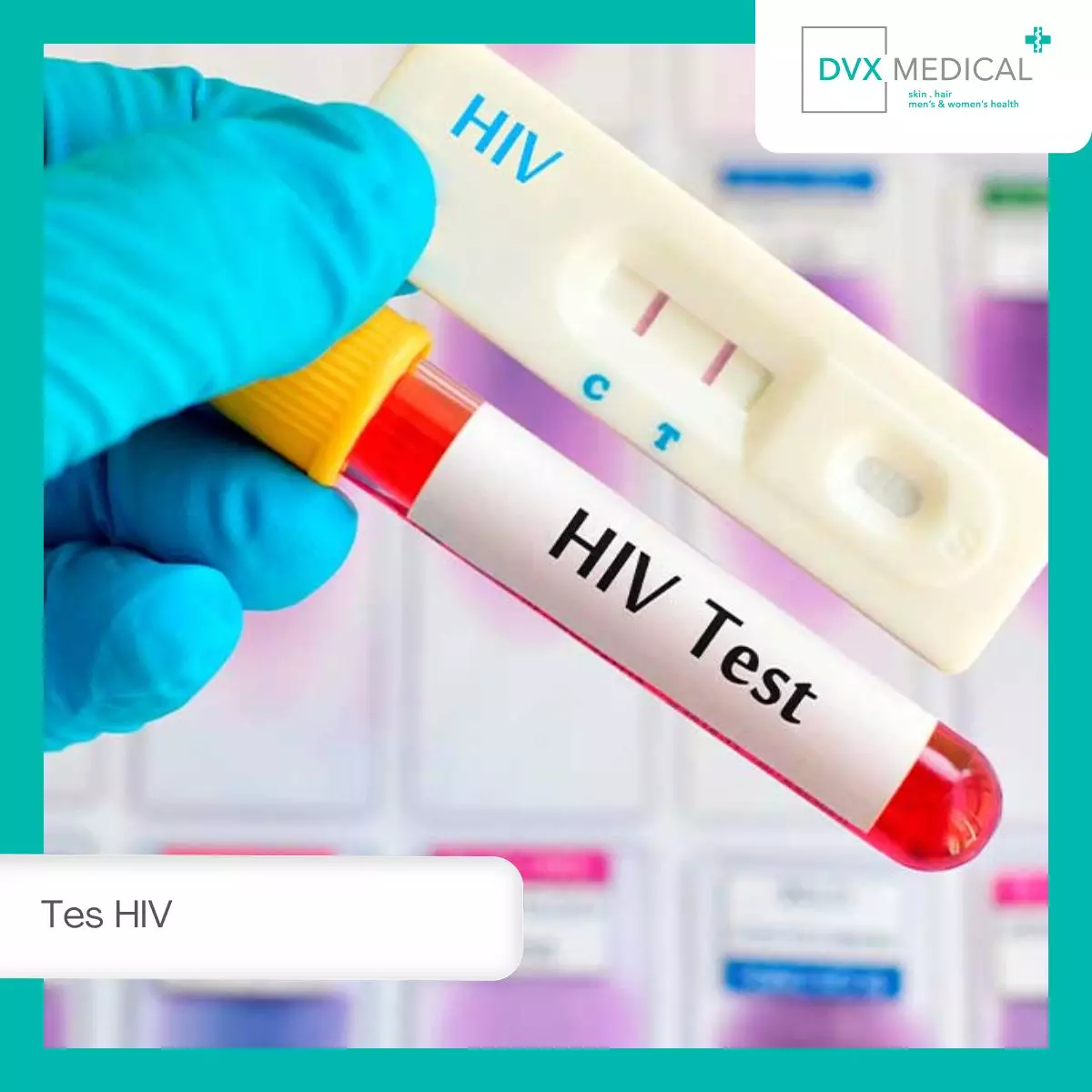 Kapan Waktu Terbaik untuk Tes HIV?