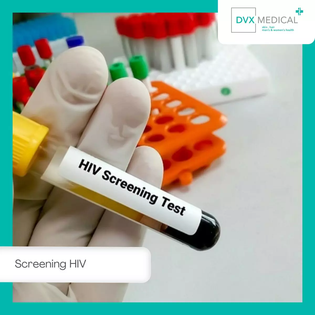 Apa Itu Screening HIV dan Mengapa Penting?