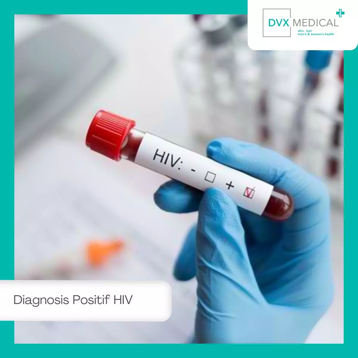 Langkah-Langkah Setelah Diagnosis Positif HIV
