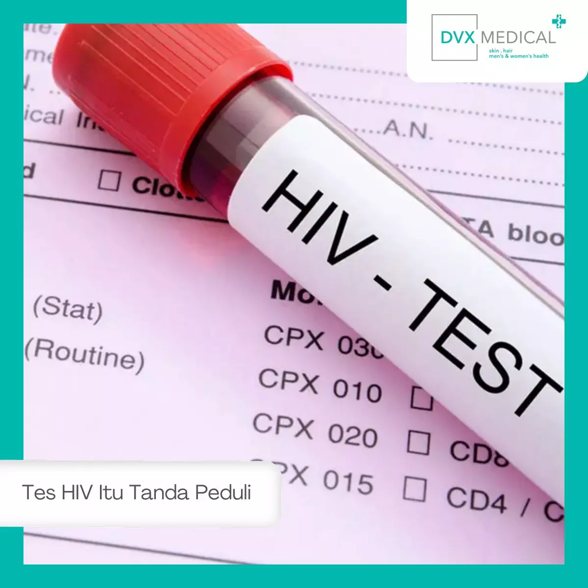 Ayo Lawan Stigma, Tes HIV Itu Tanda Peduli