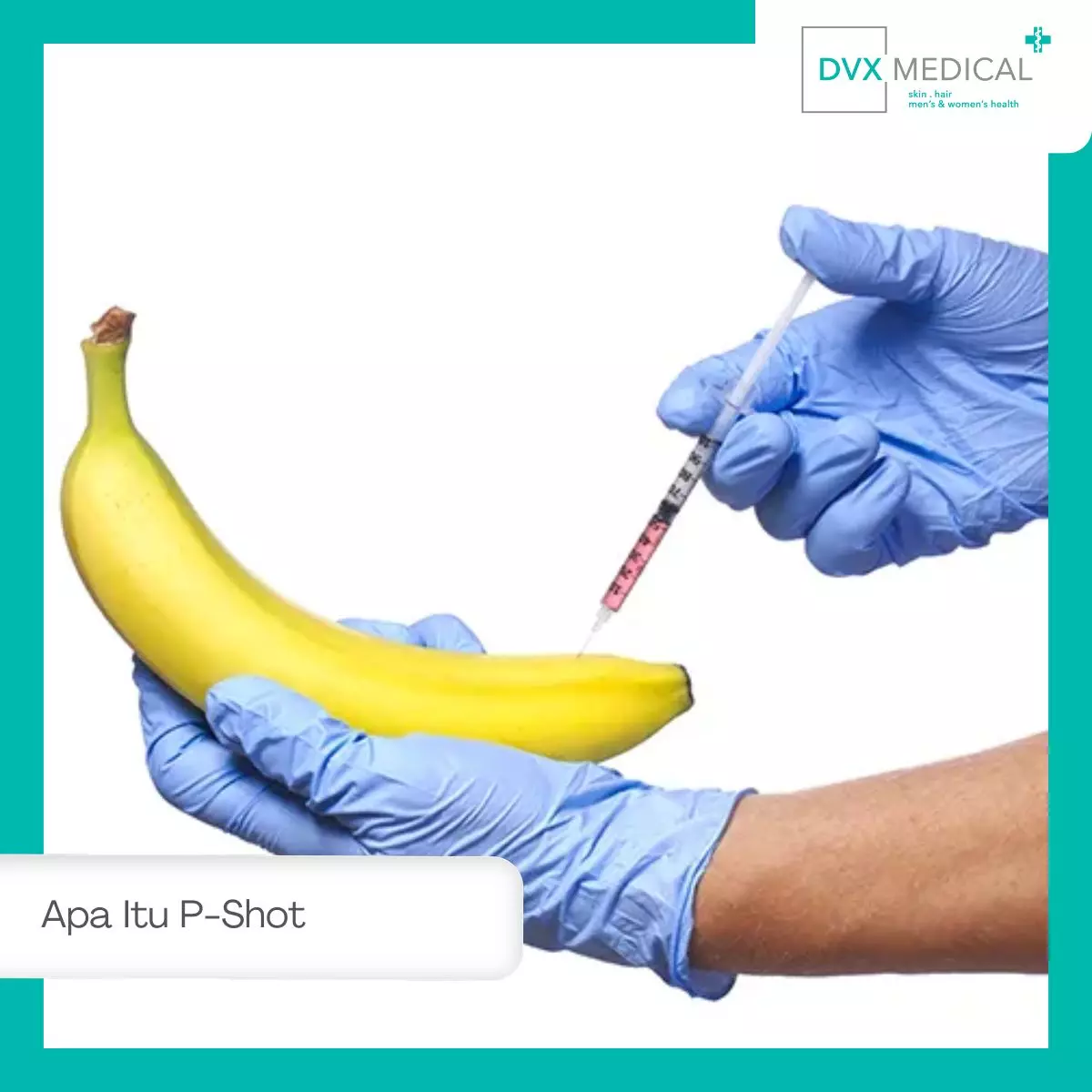 Apa Itu P-Shot (Priapus Shot)?