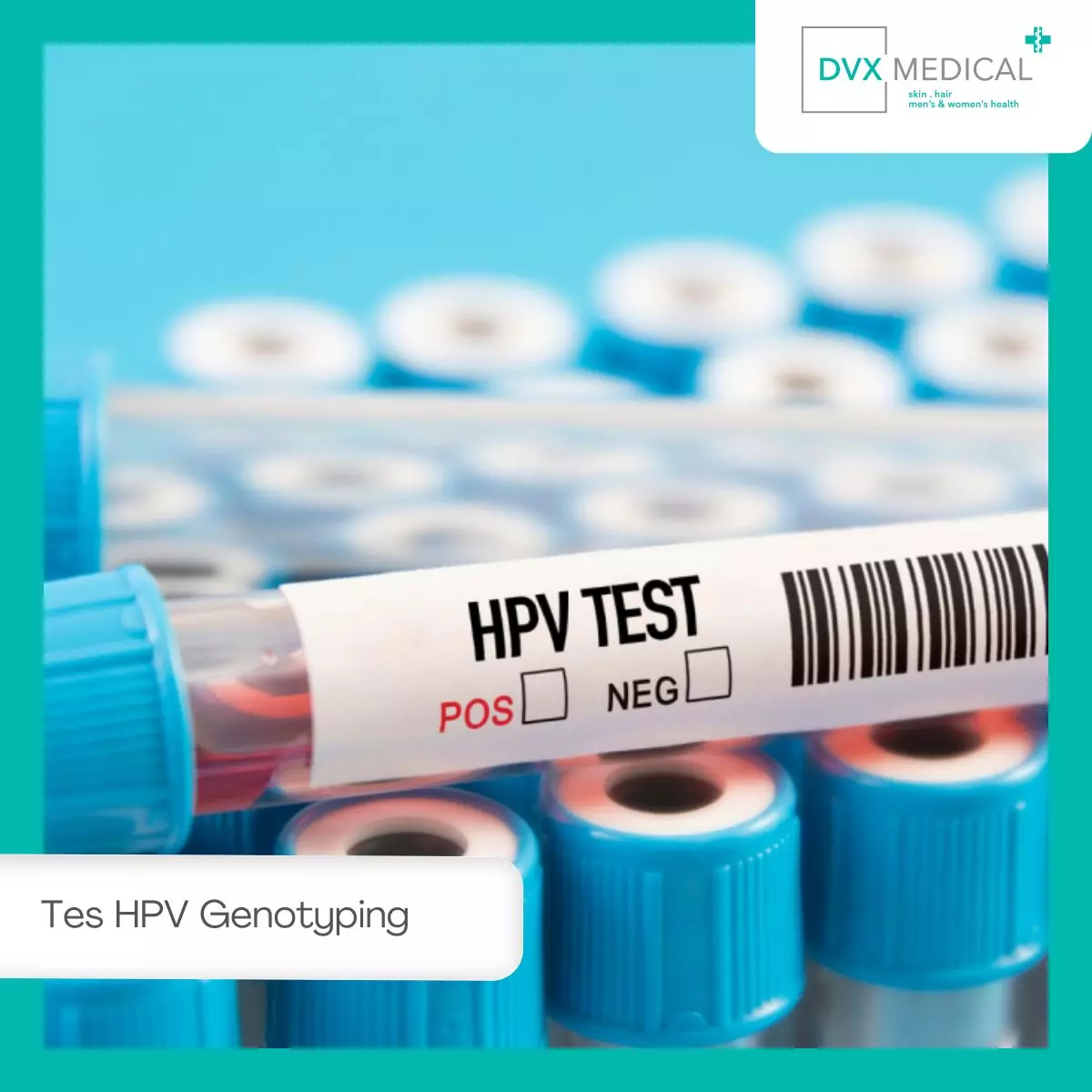 Apa Itu Tes HPV Genotyping?