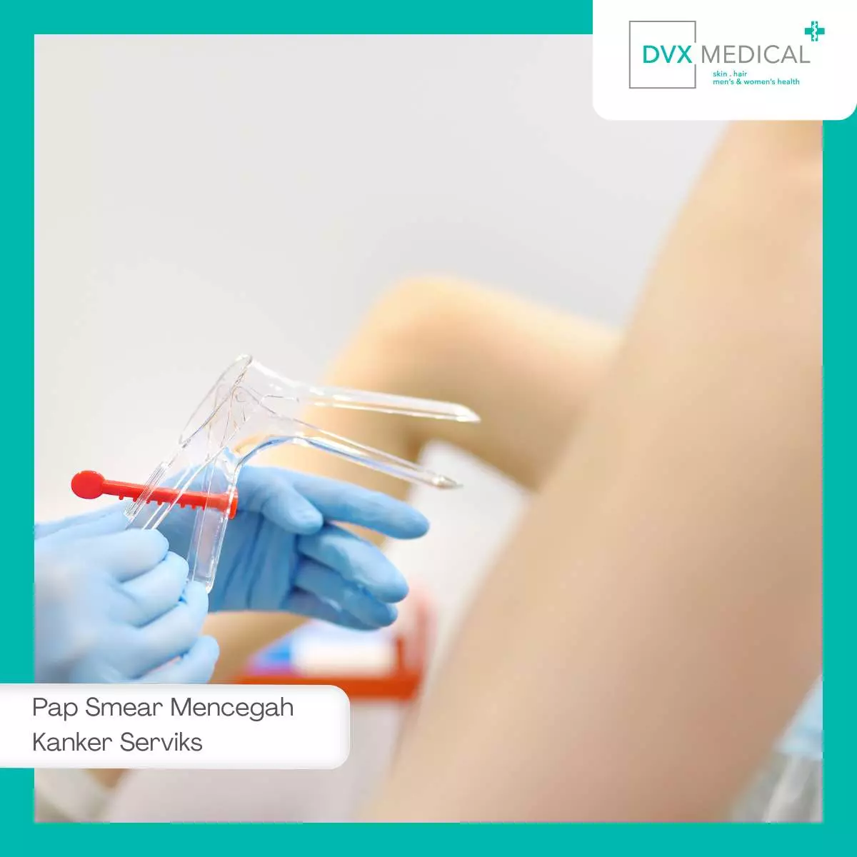 Kapan Sebaiknya Melakukan Pap Smear?