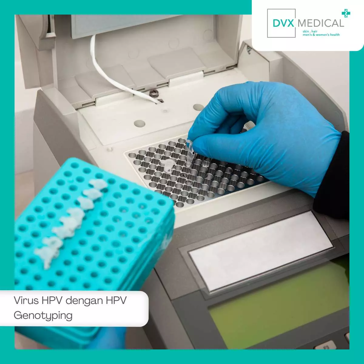 Mengenal Lebih Dekat Pemeriksaan HPV Genotyping