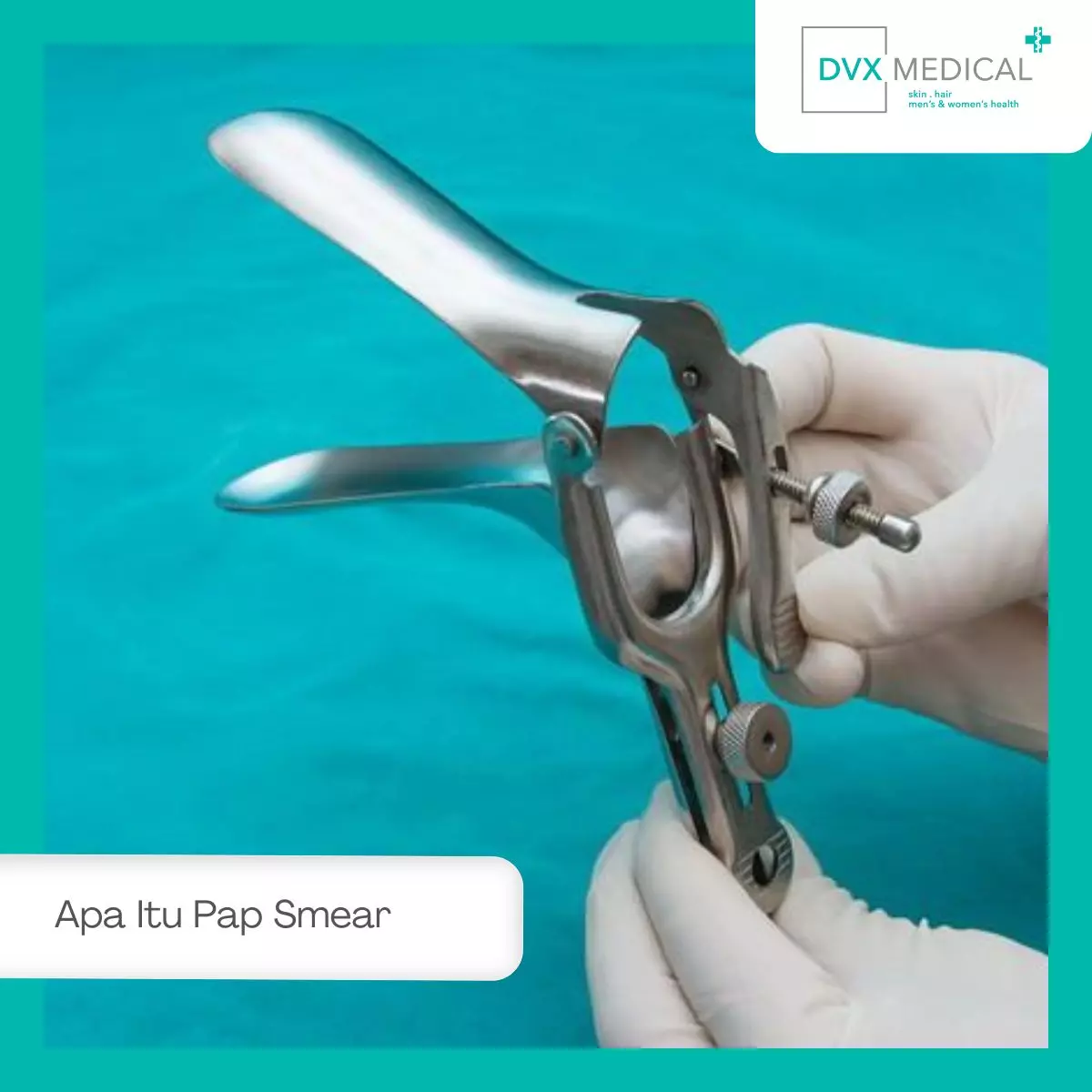 Apa Itu Pap Smear dan Kenapa Perlu Dilakukan?