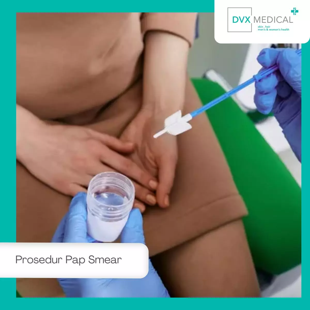Prosedur Pap Smear, Cepat dan tidak Menakutkan
