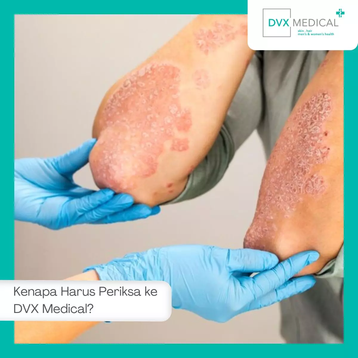 Kenapa Harus Periksa ke DVX Medical?
