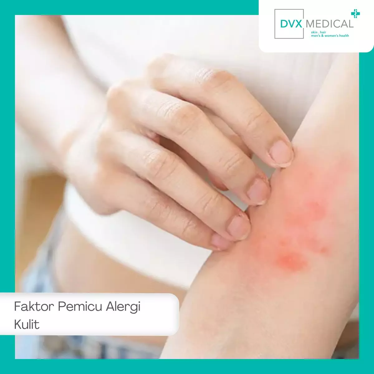 Penyebab dan Faktor Pemicu Alergi Kulit