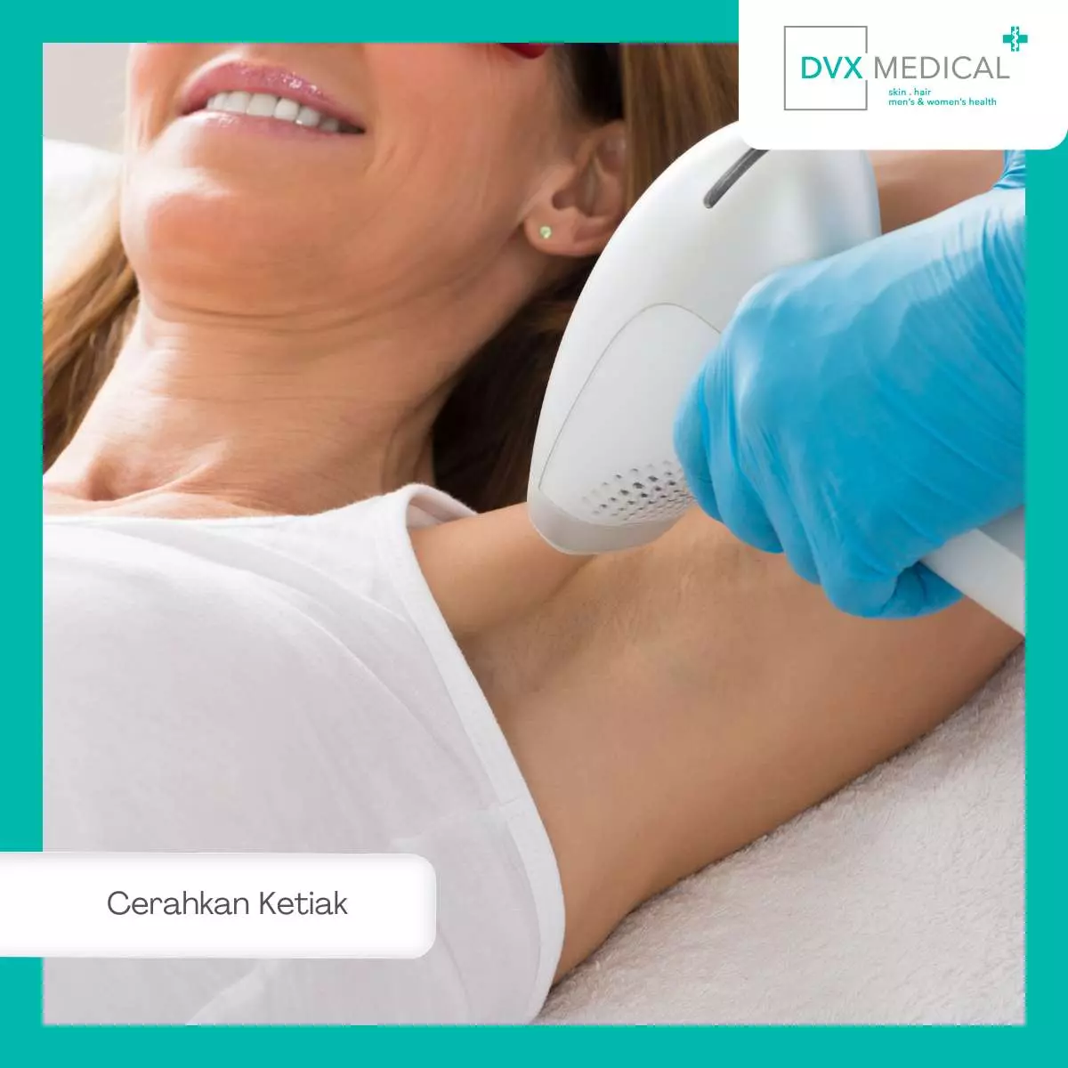 Keunggulan Treatment Whitening Ketiak di DVX Medical Surabaya