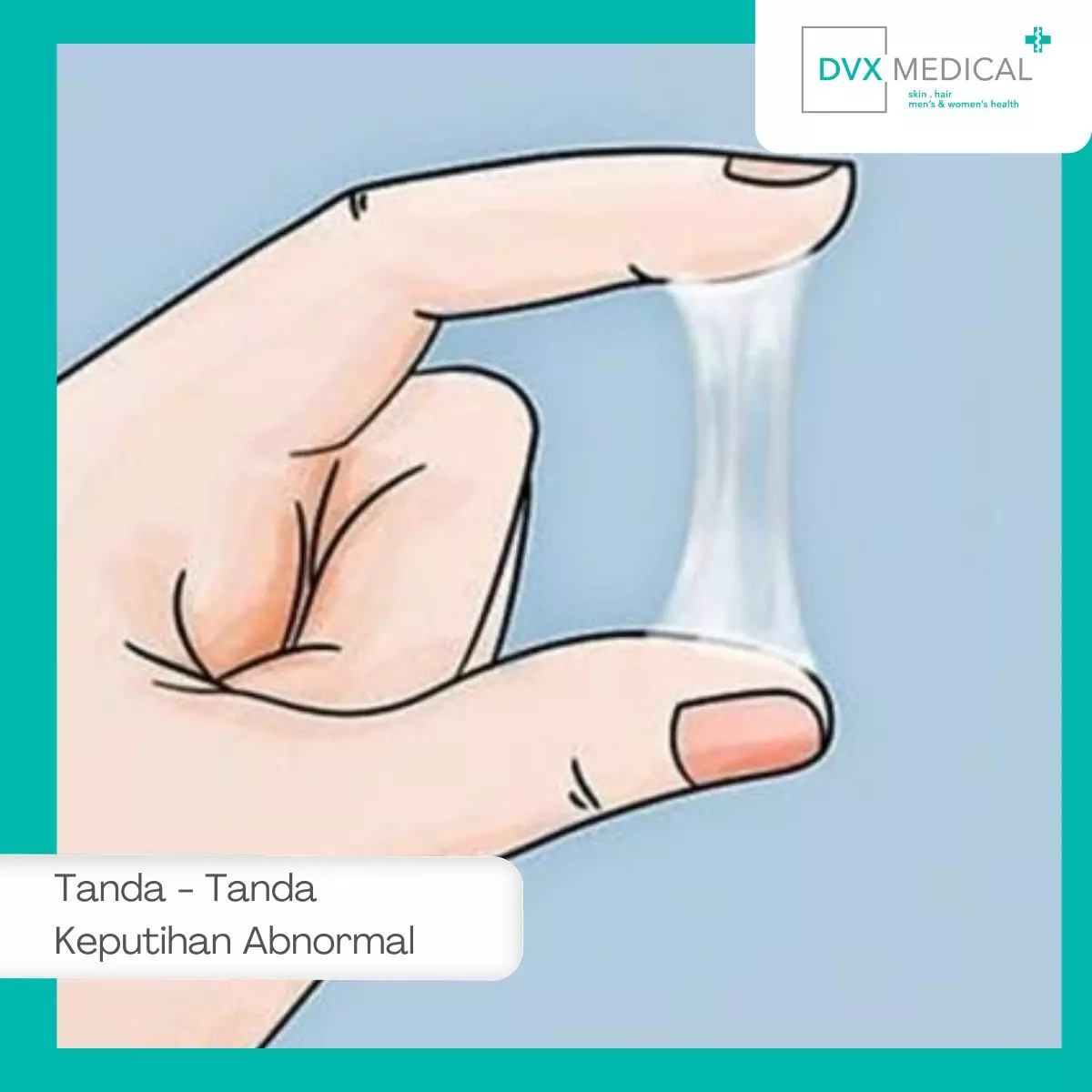 Tanda-Tanda Keputihan Abnormal yang Perlu Diwaspadai