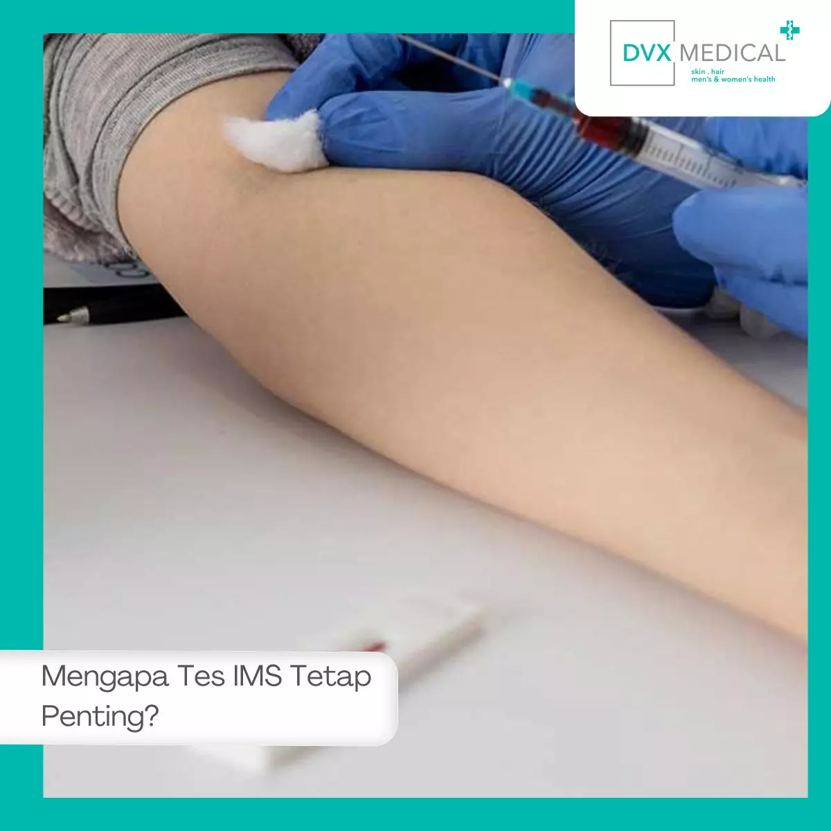 Mengapa Tes IMS Tetap Penting?